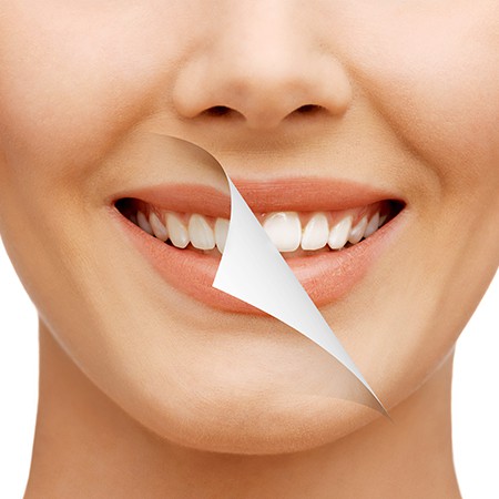 cosmetic-dentistry_f6417d78d75b5877078dd385e7247fdd